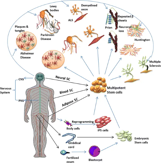 Un graphique illustrant les maladies potentielles que les traitements par cellules souches pourraient traiter dans le domaine de la neurologie.
