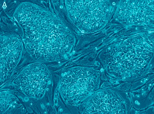 Comment optimiser les résultats de votre thérapie par cellules souches ?