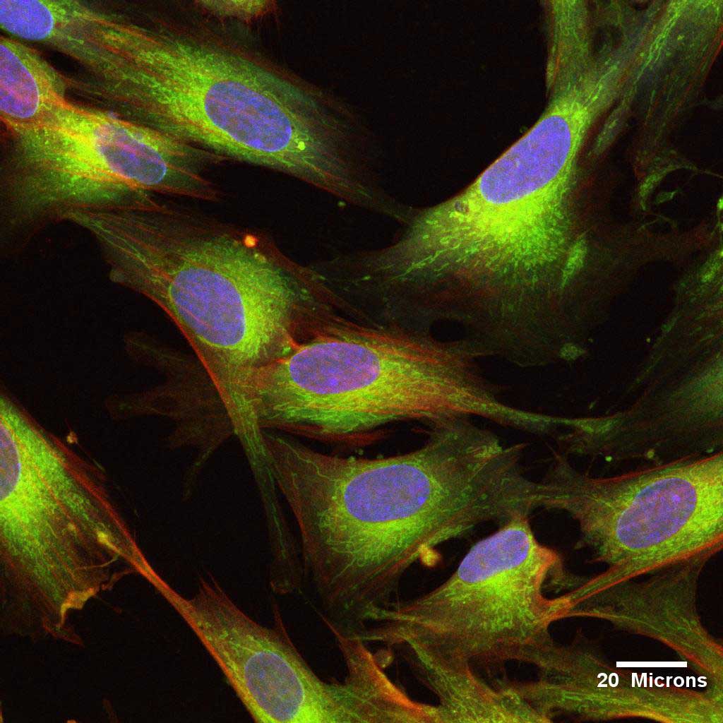 Cellules souches mésenchymateuses dérivées de cordon ombilical (UCMSC)
