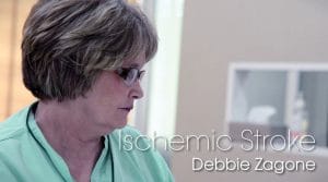 Stroke-Debbie-Zagone